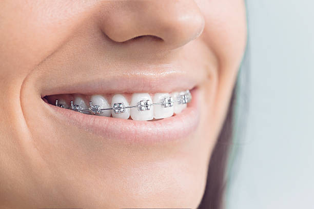 Best Tooth Extraction  in Cuyahoga Falls, OH